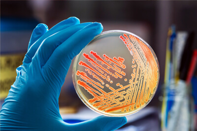 Chromogenic Substrates