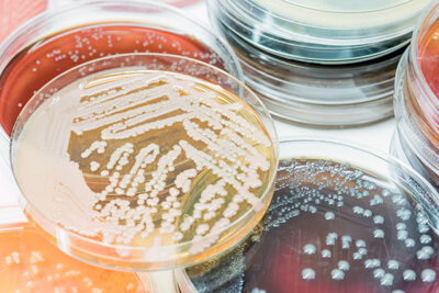 By Enzyme Activity